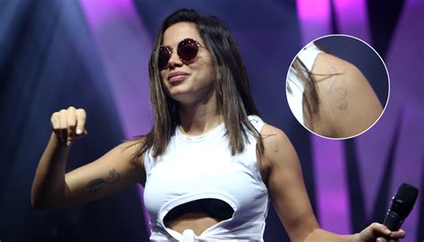 tatuagem anus anitta|Tatuador revela detalhes sobre desenho no ânus de。